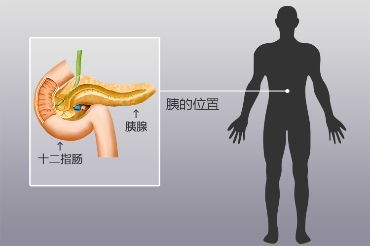 胰的位置图